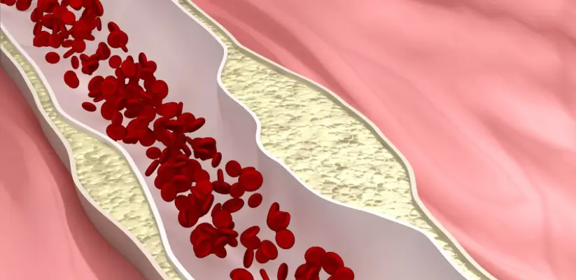 Colesterolo nel flusso sanguigno